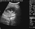 20090909